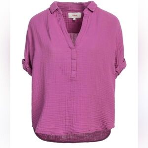 XiRENA Gauze Popover Top